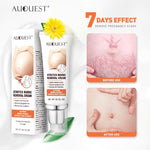 Maternity Scars Acne Cream Pregnancy Stretch Marks Remove Cream 7 Day Effect ESSENTI Skin Care Repair Anti-White Stretch 45g